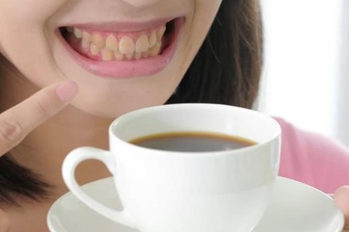 5 طرق لتنظيف الأسنان بعد شرب القهوة