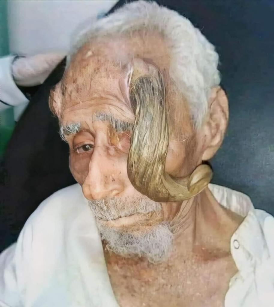 صورة حول : وفاة المعمر اليمني ذي القرنين عن عمر ناهز ١٤٠ عاما - صور وفاة المعمر اليمني ذي القرنين عن عمر ناهز ١٤٠ عاما - صور