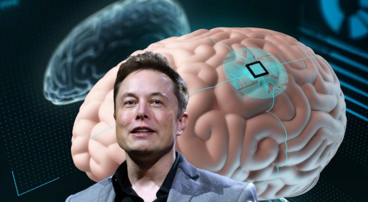 صورة حول : تجربة زراعة شريحة في دماغ الإنسان بقيادة إيلون ماسك زراعة شريحة في دماغ الإنسان بقيادة إيلون ماسك