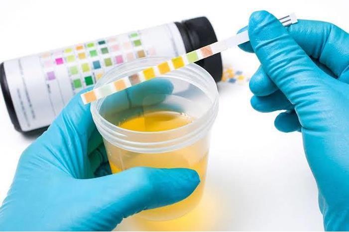 لماذا يتغير لون ورائحة البول؟