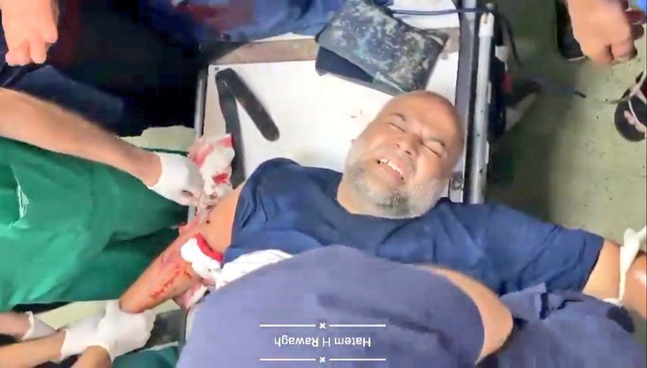 صورة حول : إصابة مراسل الجزيرة وائل الدحدوح بالرصاص في خان يونس إصابة مراسل الجزيرة وائل الدحدوح بالرصاص في خان يونس