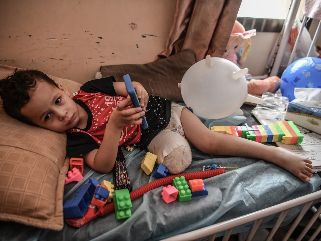 صورة حول : 10 أطفال يفقدون يوميا سيقانهم في غزة 10 أطفال يفقدون يوميا سيقانهم في غزة