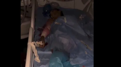 انقطاع الكهرباء عن مجمع ناصر الطبي بخانيونس.. واستشهاد مصابين