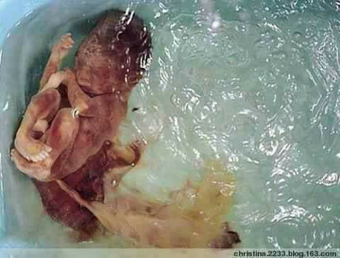 صورة حول : شوربة الأجنة المجهضة في الصين وصفة جديدة للصحة والجمال شوربة الأجنة المجهضة في الصين وصفة جديدة للصحة والجمال