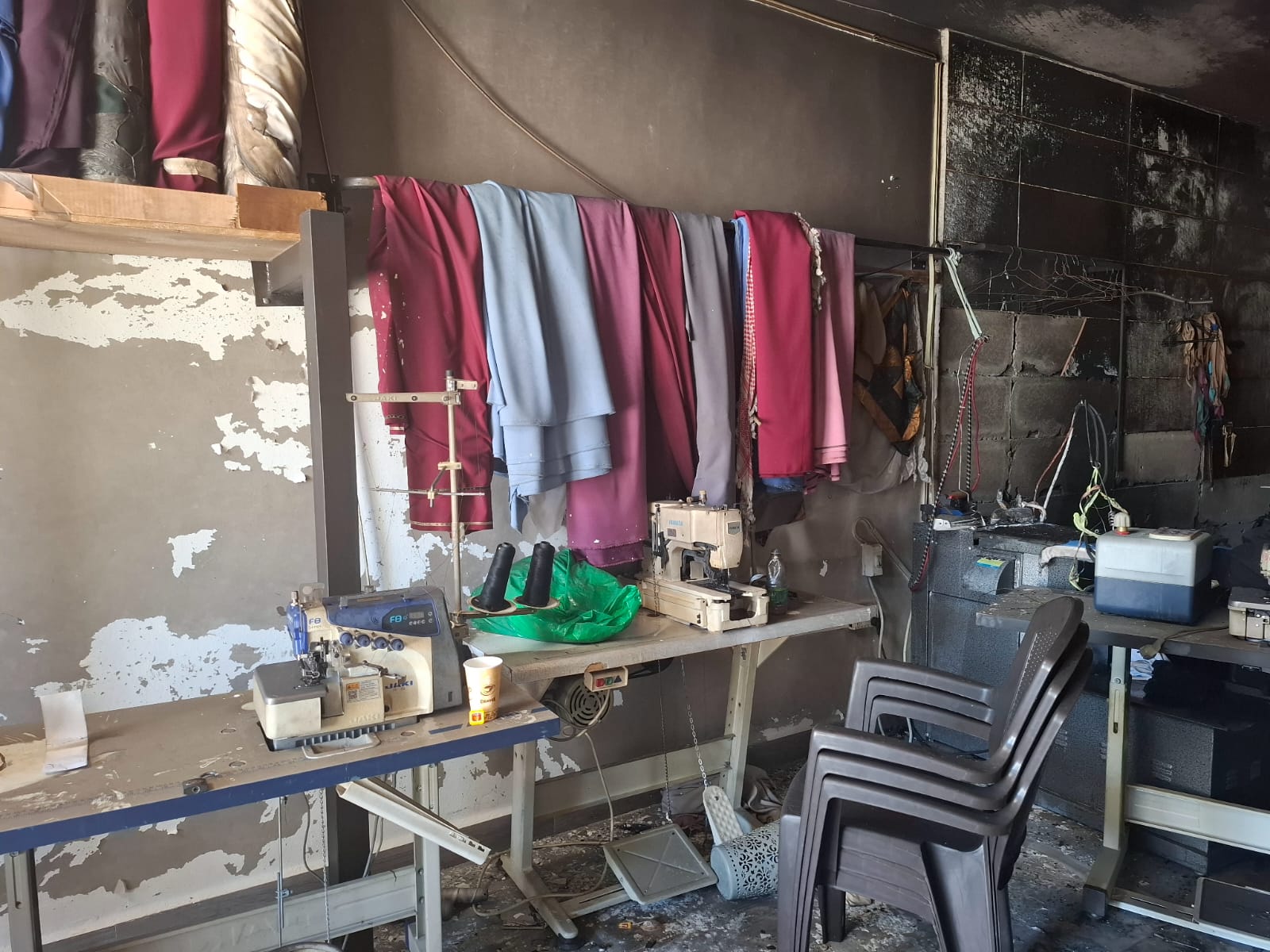 احتراق مخيطة C.F بالكرك احدى صديقات التليف الكيسي 