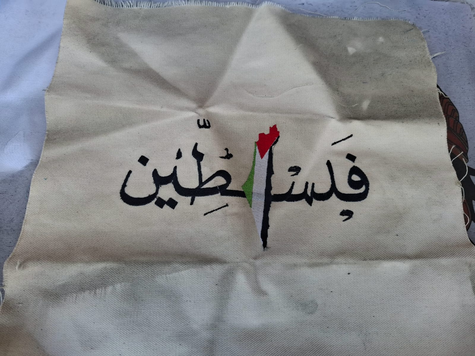 احتراق مخيطة C.F بالكرك احدى صديقات التليف الكيسي 