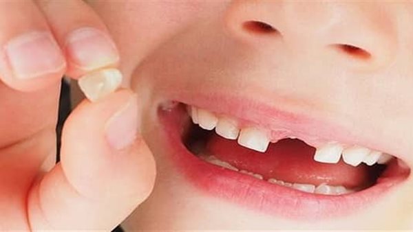 تفسير حلم سقوط الأسنان.. معاني ودلالات مختلفة للرجل والمرأة