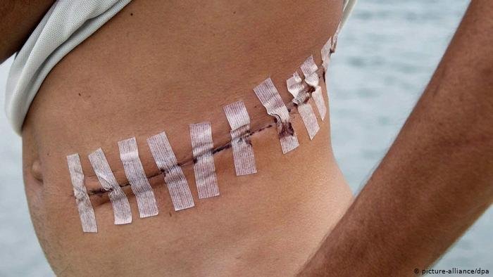 قصة خيانة مأساوية..زوج يبيع كليته لابنته وزوجته تسرق المال وتهرب!