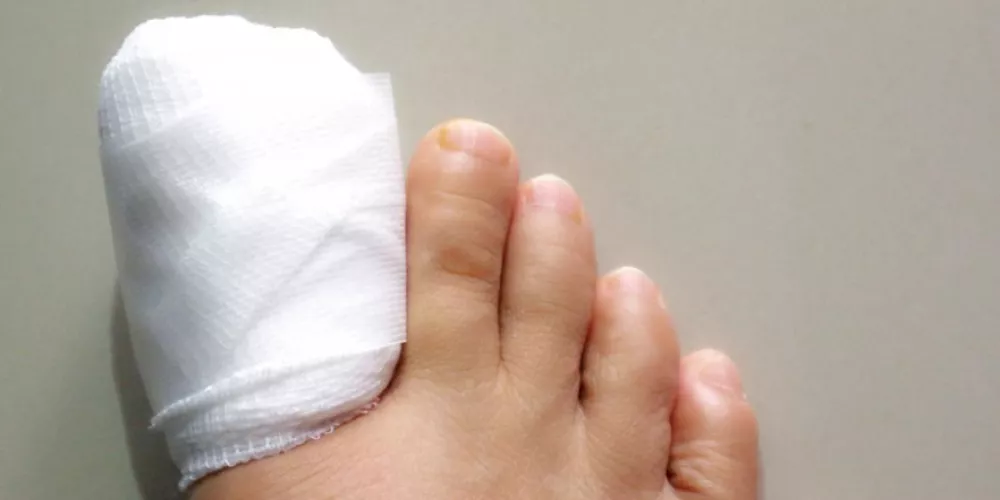 صورة حول : ما بعد استئصال الظفر: تعليمات طبية مهمة لتسريع الشفاء وتجنب المضاعفات ما بعد استئصال الظفر: تعليمات طبية مهمة لتسريع الشفاء وتجنب المضاعفات