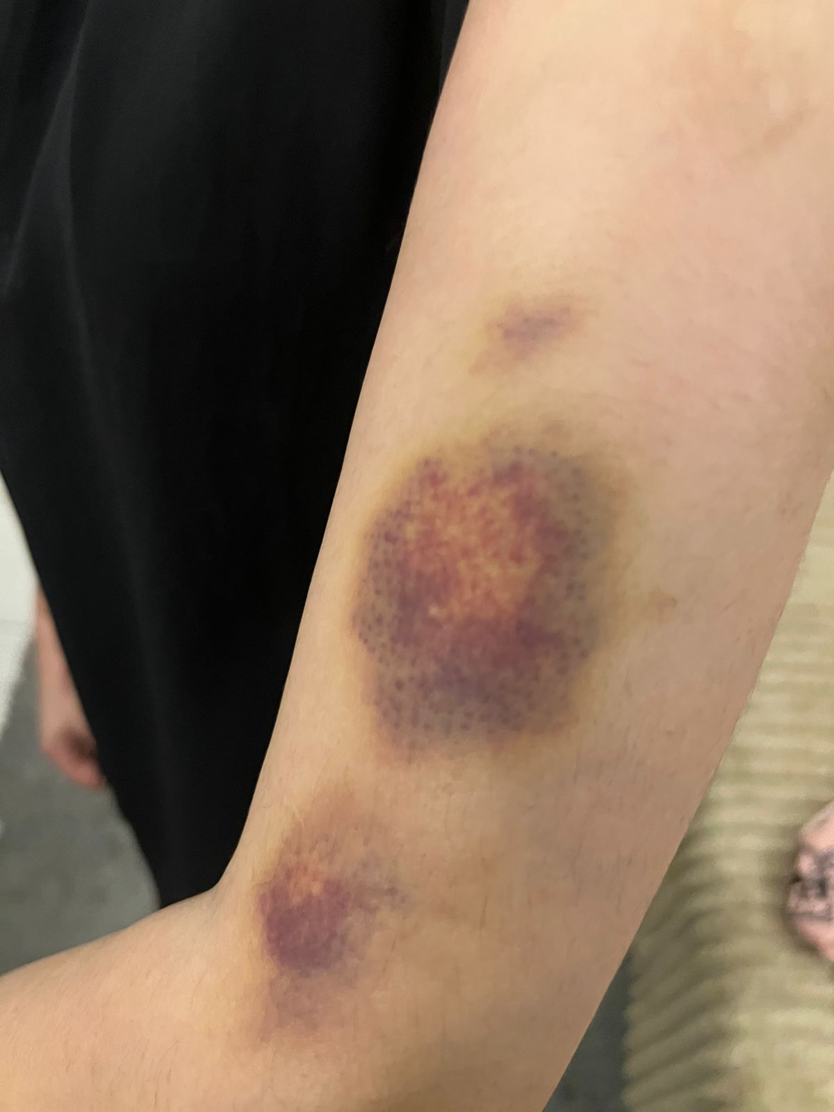 عاجل | أحمد يخرج عن صمته ويكشف تفاصيل تعذيبه هو وشقيقته على يد والده وإخوته .. فيديو وصور