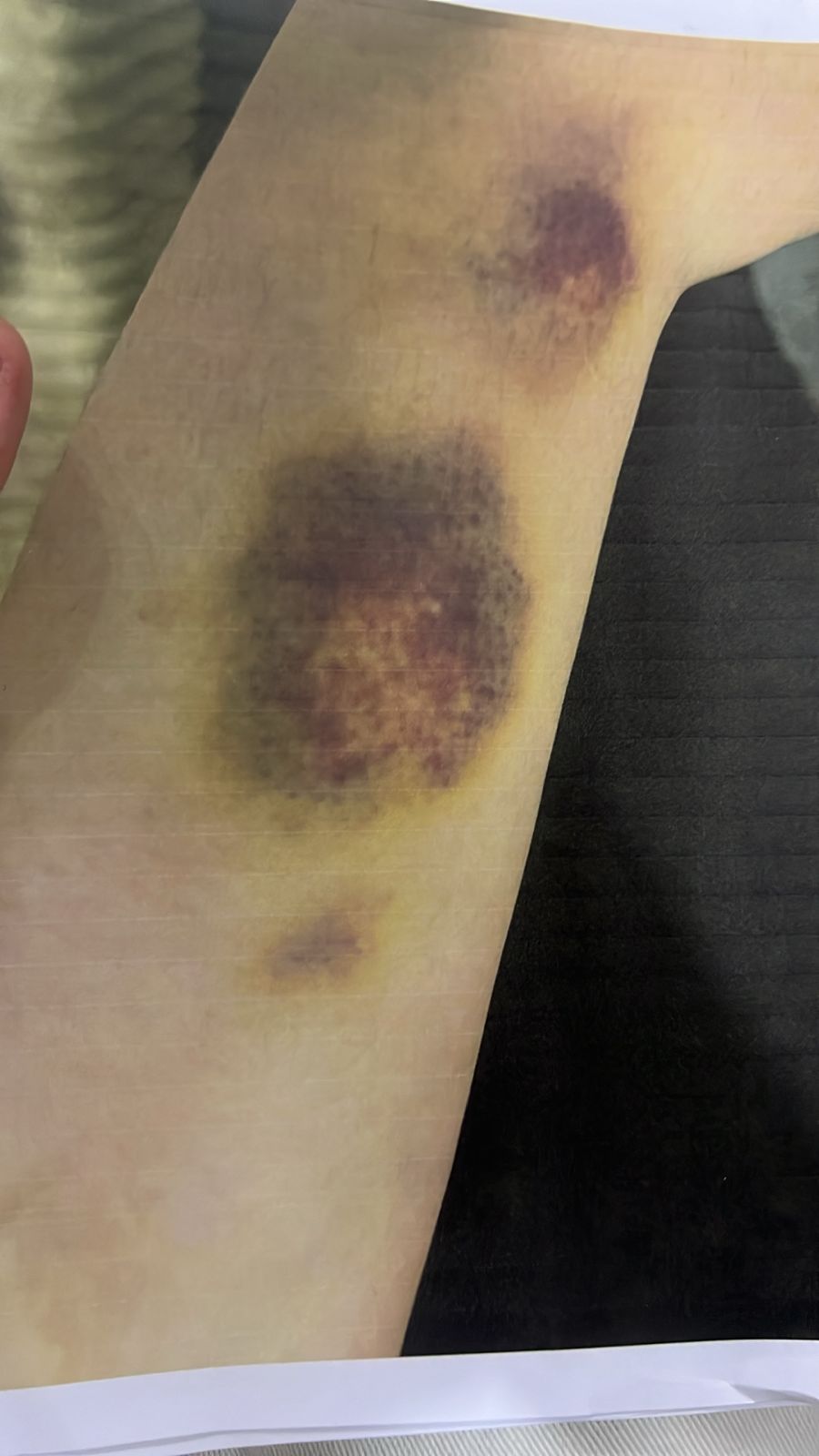 صورة حول : عاجل | أحمد يخرج عن صمته ويكشف تفاصيل تعذيبه هو وشقيقته على يد والده وإخوته .. فيديو وصور عاجل | أحمد يخرج عن صمته ويكشف تفاصيل تعذيبه هو وشقيقته على يد والده وإخوته .. فيديو وصور