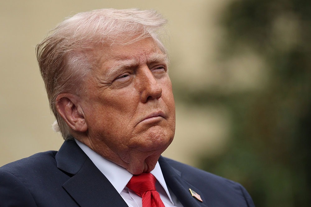 ظهور وجه مترهل لترمب يثير تساؤلات جديدة حول صحته