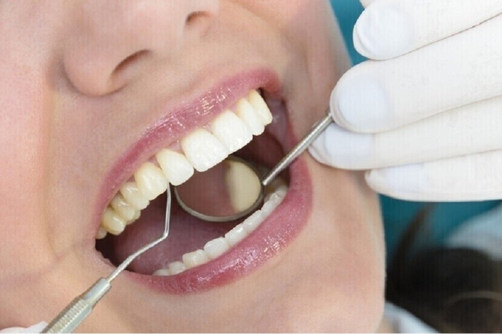 صورة حول : أخصائية أسنان تحذر من تجاهل طقطقة الفك وتآكل الأسنان أخصائية أسنان تحذر من تجاهل طقطقة الفك وتآكل الأسنان