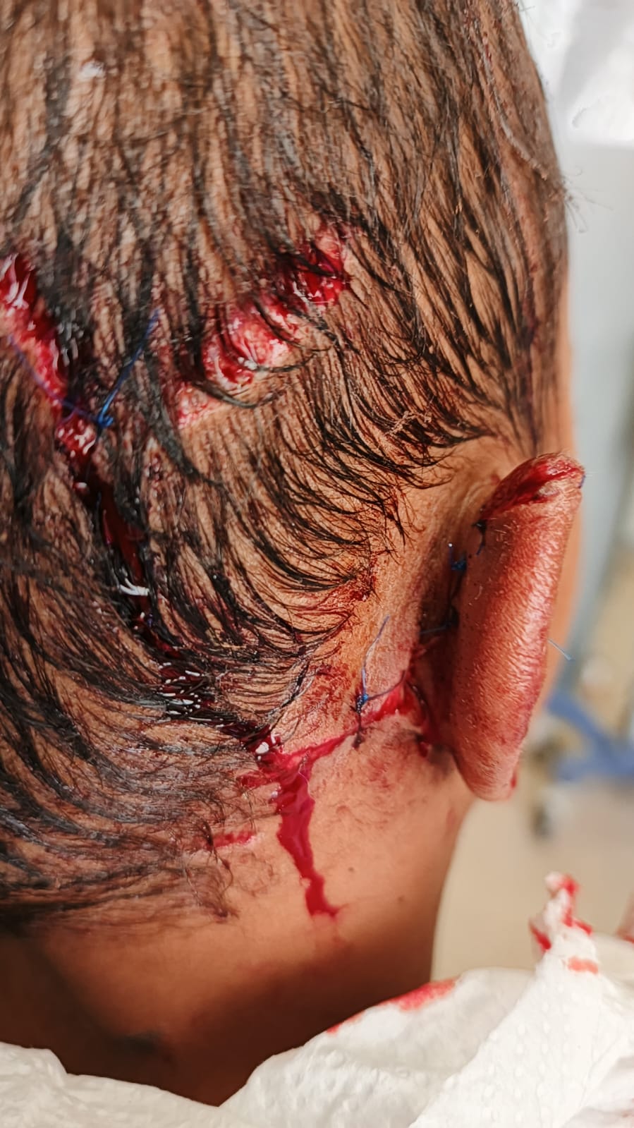 صورة حول : أطفالنا في خطر… من يحميهم من الكلاب الضالة؟ أطفالنا في خطر… من يحميهم من الكلاب الضالة؟