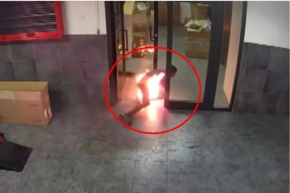 صورة حول : شاب يحرق زميله ويصيب جسده بعجز دائم في أنطاليا شاب يحرق زميله ويصيب جسده بعجز دائم في أنطاليا