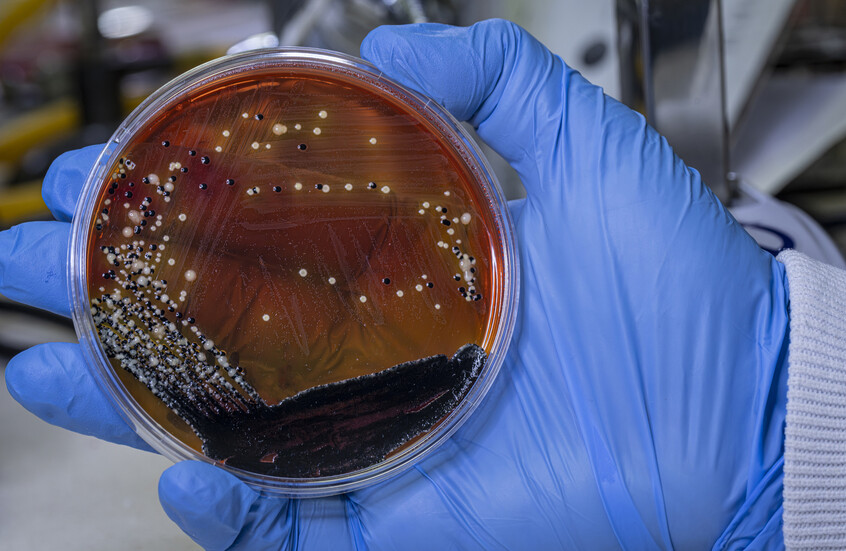 بكتيريا الأمعاء تتحدى الفضاء… تهديد أم فرصة لرواد الفضاء؟