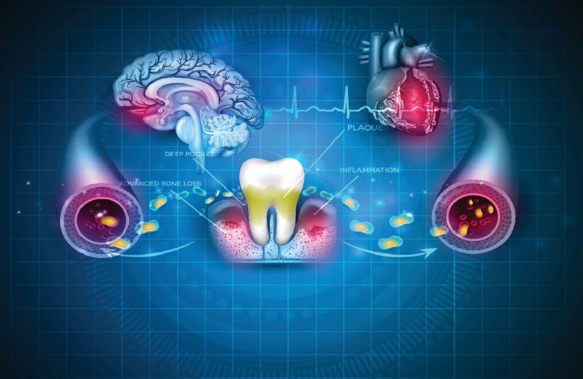 صورة حول : ابتسامتك قد تكلفك دماغك! دراسات تكشف صلة قوية بين أمراض اللثة وتلف الدماغ ابتسامتك قد تكلفك دماغك! دراسات تكشف صلة قوية بين أمراض اللثة وتلف الدماغ