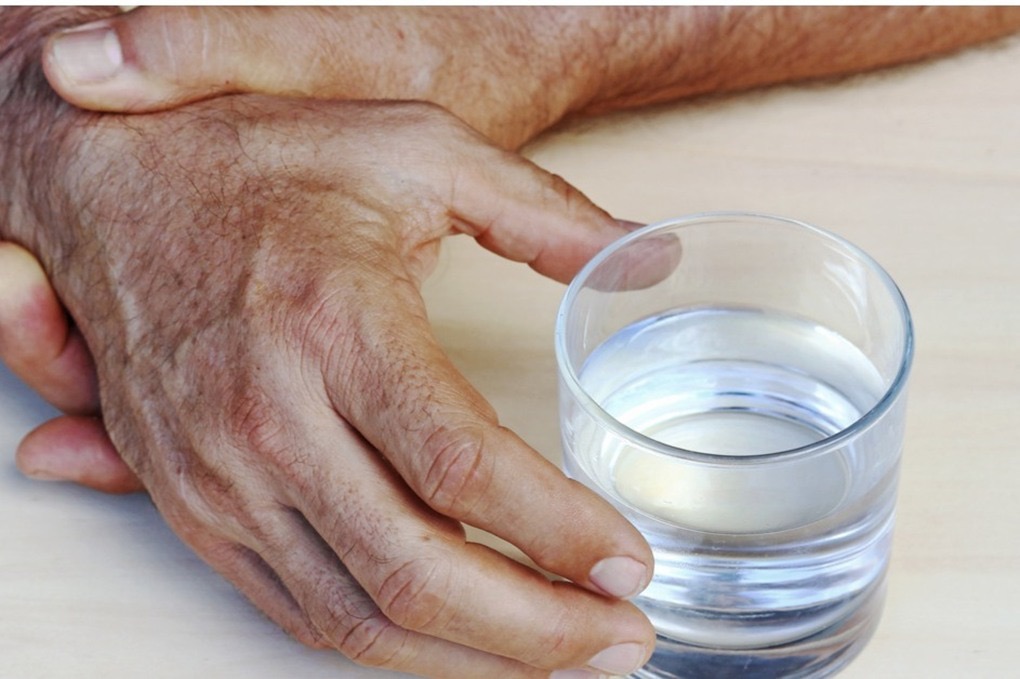 صورة حول : هل شرب الماء يومياً يقيك من النقرس وحصوات الكلى؟ هل شرب الماء يومياً يقيك من النقرس وحصوات الكلى؟