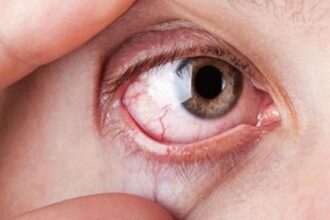 الخريف يفاقم إجهاد العينين… نصائح للحفاظ على الرؤية