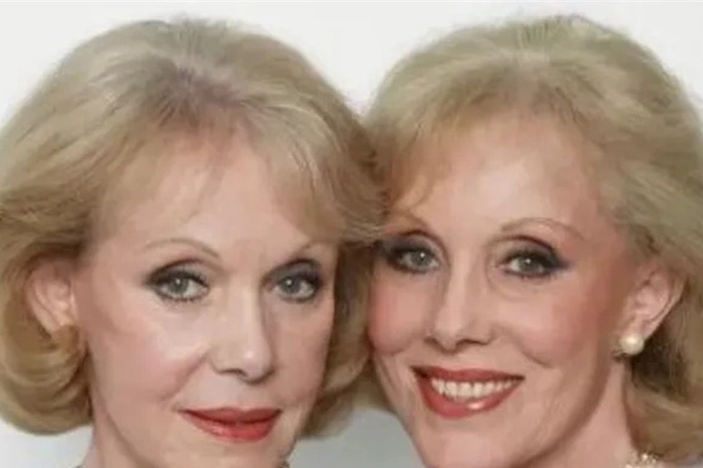 انتحار اشهر التوأمتين في أوروبا بقرار "موت مُساعد"