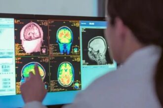 دراسة تكشف مراحل تطور الدماغ من الطفولة حتى الشيخوخة