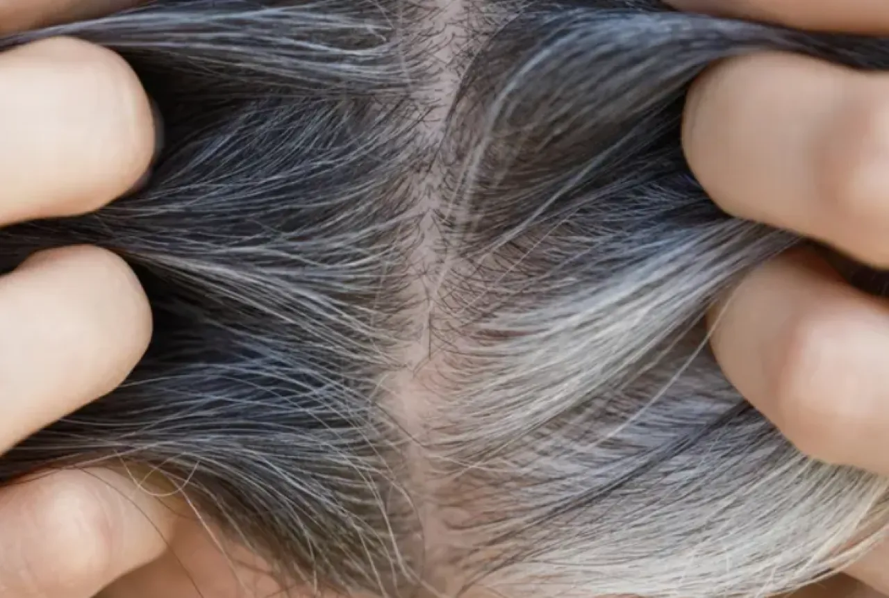 هل الشيب الرمادي يحميك من السرطان؟