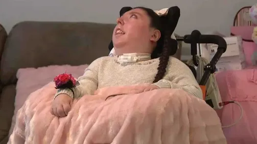 صورة حول : طفلة وُلدت بلا دماغ تحتفل بمعجزة عيد ميلادها العشرين طفلة وُلدت بلا دماغ تحتفل بمعجزة عيد ميلادها العشرين