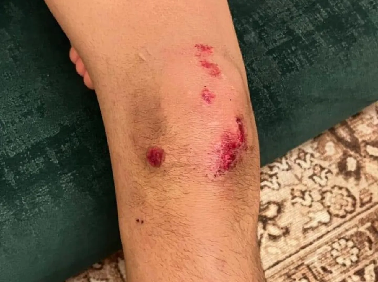 المفرق: 4 كلاب ضالة تهاجم طفلا