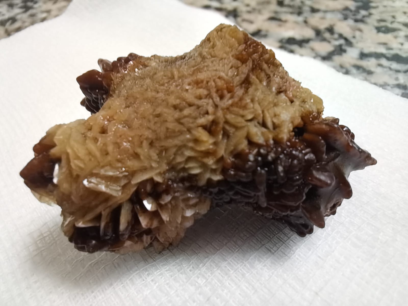 صورة حول : مادبا: عملية نوعية لاستخراج حصوة من الكلى مادبا: عملية نوعية لاستخراج حصوة من الكلى