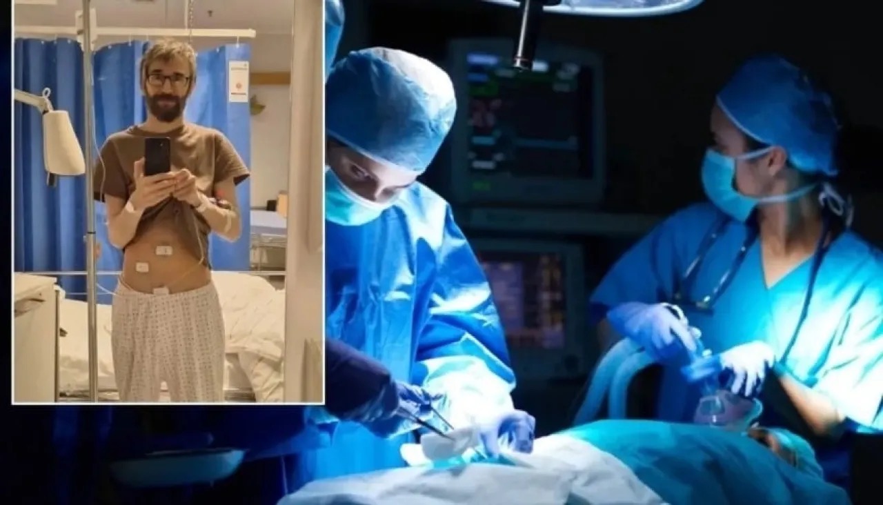 الذكاء الاصطناعي ينقذ حياة مريض قبل انفجار الزائدة الدودية