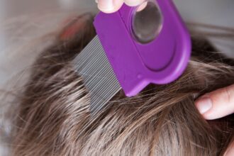 فطريات فروة الرأس… كيف تنتقل وما هي أعراضها؟