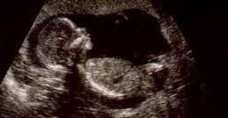 اكتشاف جنين داخل امرأة منذ 40 عامًا دون ان تشعر .. تفاصيل