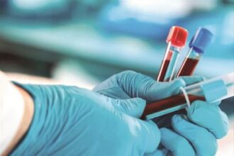 الصحة: الفحوصات الطبية للعاملات والوافدين ضرورة صحية لحماية المجتمع