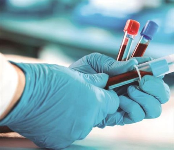 الصحة: الفحوصات الطبية للعاملات والوافدين ضرورة صحية لحماية المجتمع