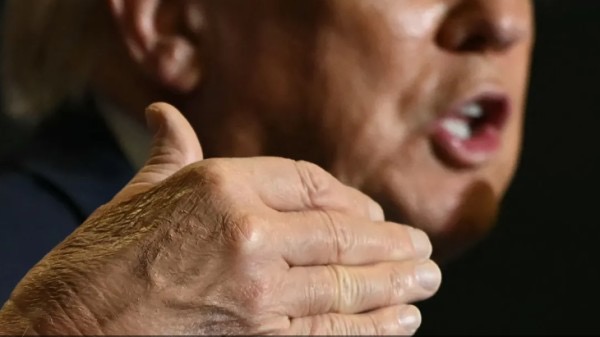 ترامب يوضح سبب الكدمات على يده وينفي استسلامه للنوم خلال المناسبات العامة