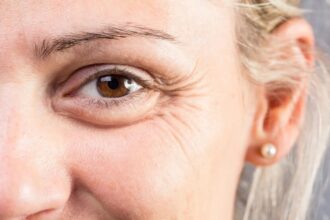 ملامح الوجه تكشف أسرار صحة الدماغ: التجاعيد قد تنبئ بالخرف وألزهايمر