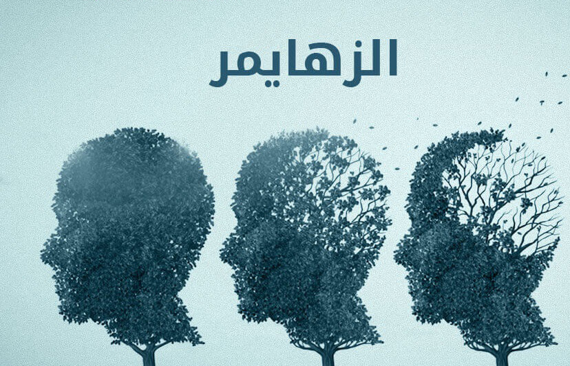 صورة حول : دراسة علمية تكشف عن دواء تجريبي يوقف الزهايمر قبل ظهور الأعراض دراسة علمية تكشف عن دواء تجريبي يوقف الزهايمر قبل ظهور الأعراض