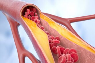 دراسة جديدة تكشف كيف يرفع نقص الدهون البيجية ضغط الدم ويهدد القلب
