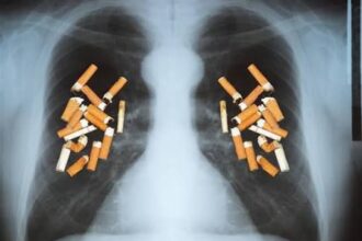 الدكتور الطراونة يوضح ..المدخن بلا أعراض ليس معافى بل يفقد نصف رئة قبل أن يشعر بأول ضيق تنفس