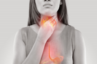 نصائح لتجنب حرقة المعدة وارتجاع المريء أثناء الصيام