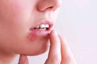 اختراق علمي في مواجهة "فيروس القبل".. أجسام مضادة بشرية تنجح في تعطيل فيروس "إبشتاين–بار"