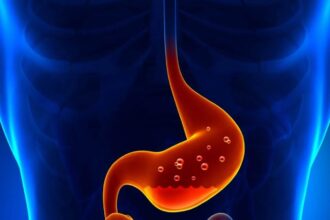 صيام بلا أوجاع.. كيف تتجنب حرقة المعدة وارتجاع المريء في رمضان؟