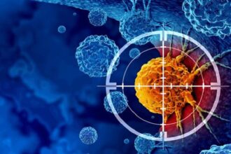 دراسة بريطانية صادمة: التهاب الأمعاء يرفع خطر الإصابة بسرطان القولون