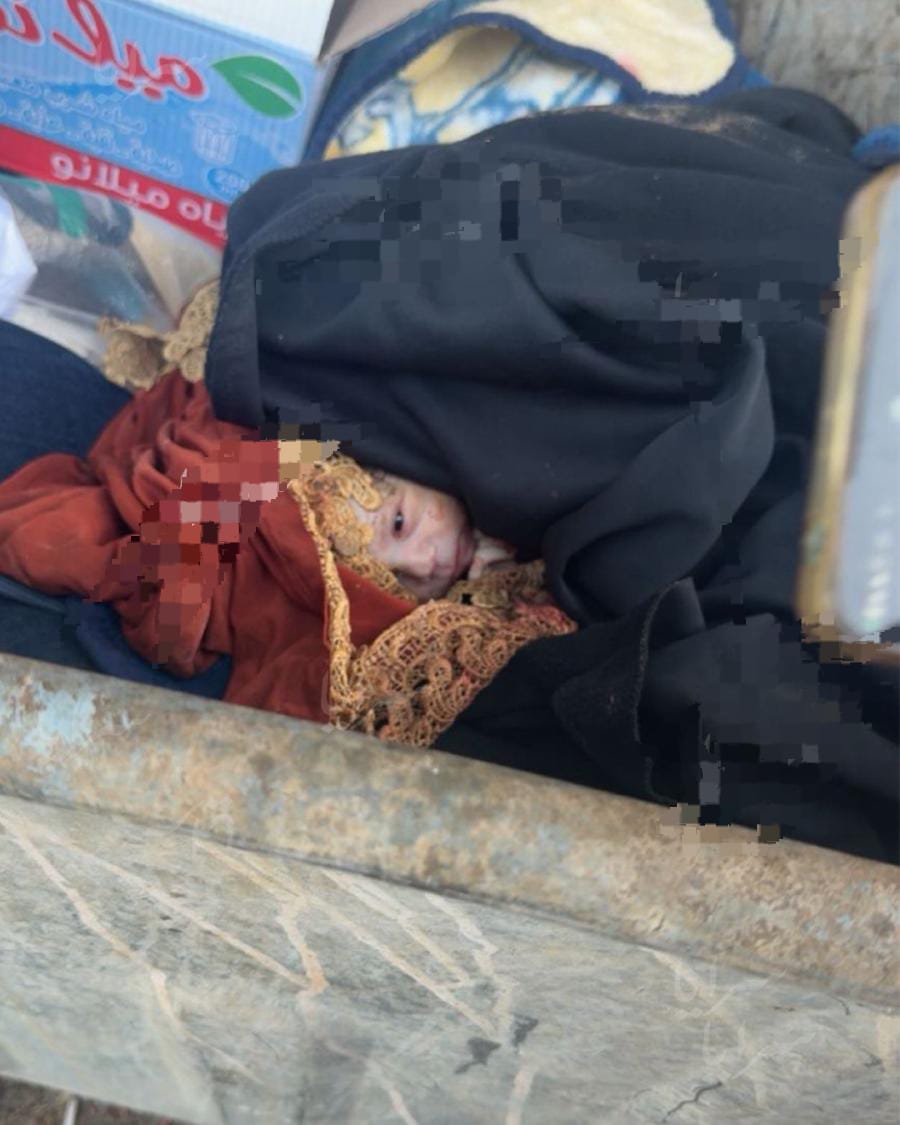 صورة حول : صدمة في محافظة الكرك.. العثور على رضيع داخل حاوية نفايات (صورة) صدمة في محافظة الكرك.. العثور على رضيع داخل حاوية نفايات (صورة)